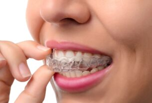 Invisalign Treatment