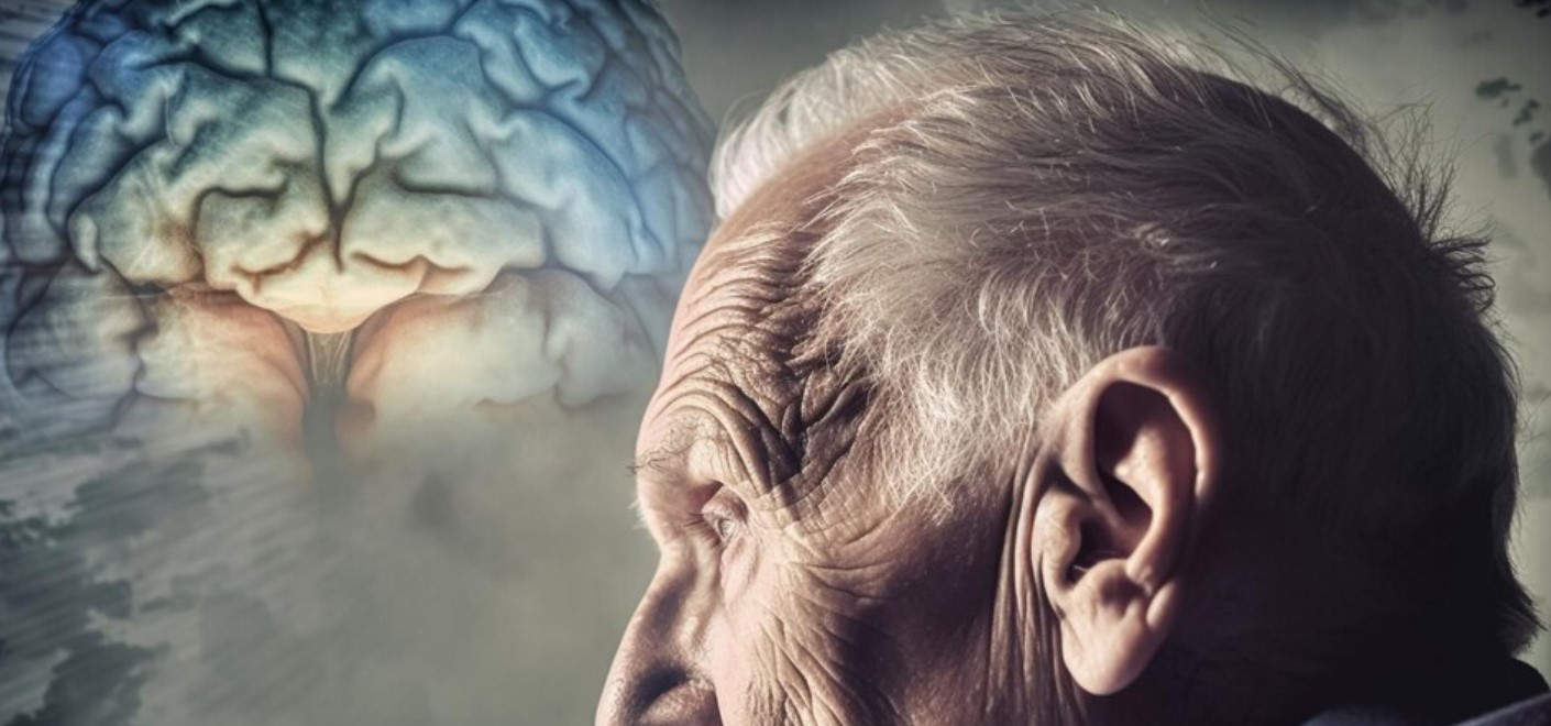 Understanding the Progression of Dementia