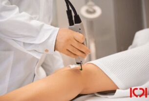 How Laser Vein Removal Can Improve Your Skin’s Appearance