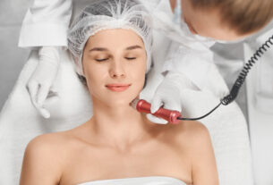 Microneedling