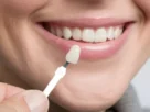 Cosmetic Dentistry Transforming Smiles and Boosting Confidence