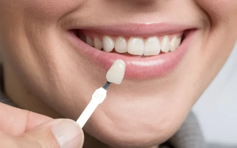 Cosmetic Dentistry Transforming Smiles and Boosting Confidence