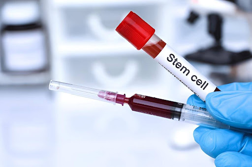 Dubai stem cell therapy