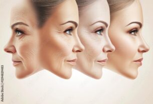 Can Dermal Fillers