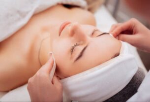 laser hair removal
