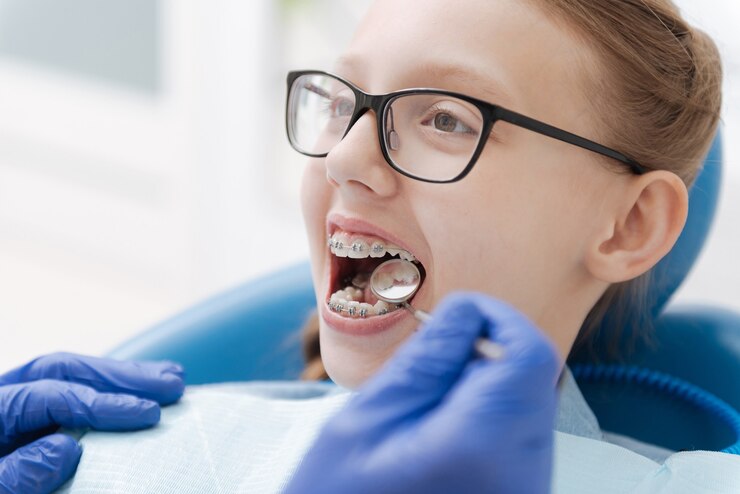 Orthodontic Issues