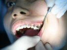 Dental