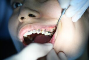 Dental