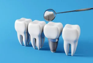 Dental Implants