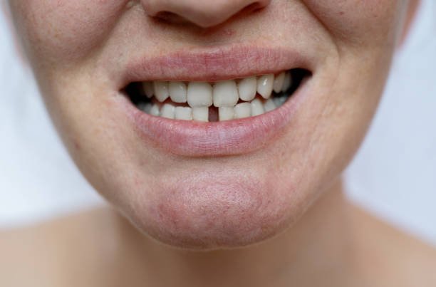 Teeth