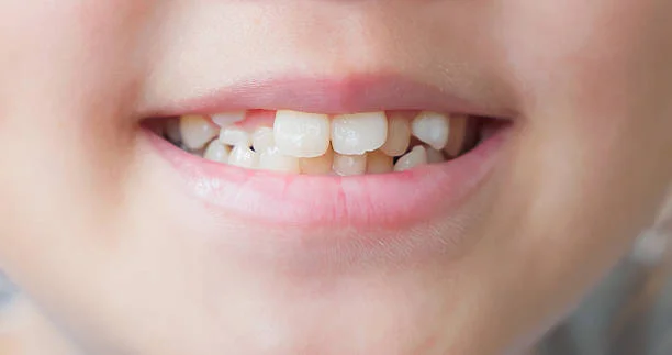 Orthodontic
